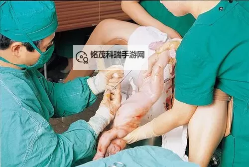 真实记录：孕妇生产过程视频全程揭秘图1