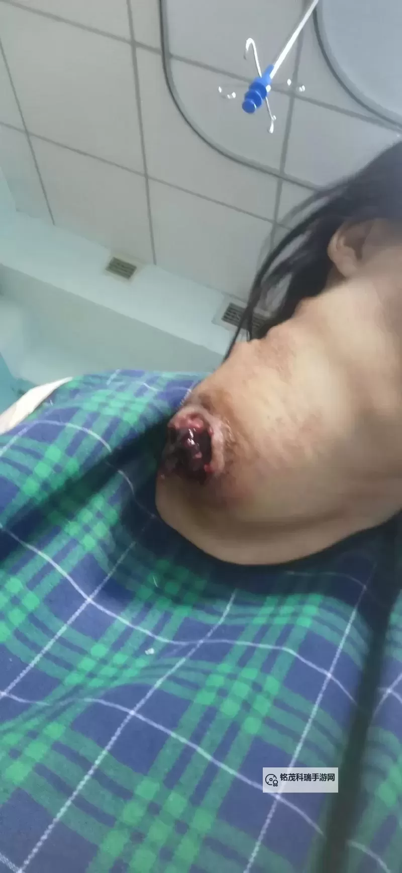 浴室少女自杀20：悲剧背后的故事与反思图1