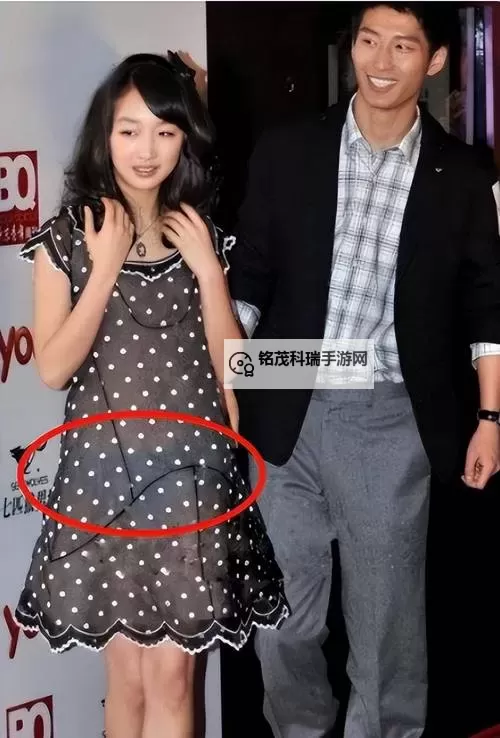 走光漏底毛：镜头下的尴尬瞬间与应对之道图1